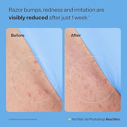 Peach Slices Smoothing Solution Ingrown Hair Treatment (1.69 oz)