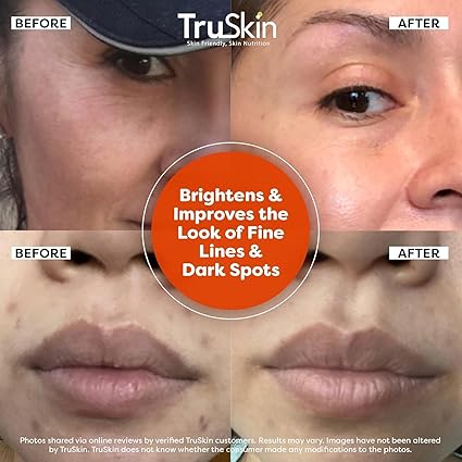 TruSkin Vitamin C Serum For Face Anti Aging Face Serum - Image 4