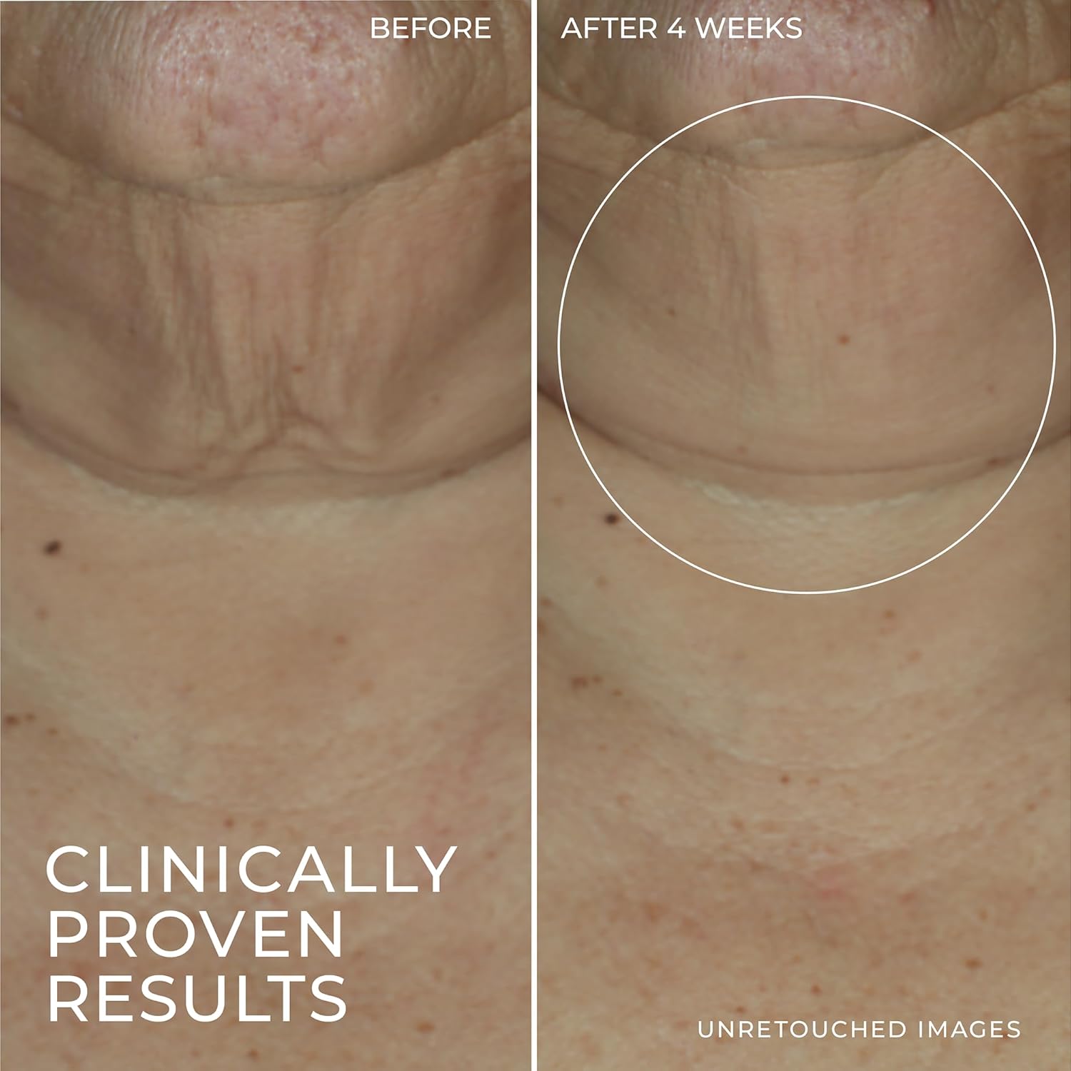 RoC Derm Correxion Retinol Firming Serum Stick