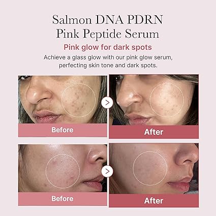 medicube Salmon DNA PDRN Pink Peptide Serum, Pink glow - Image 5